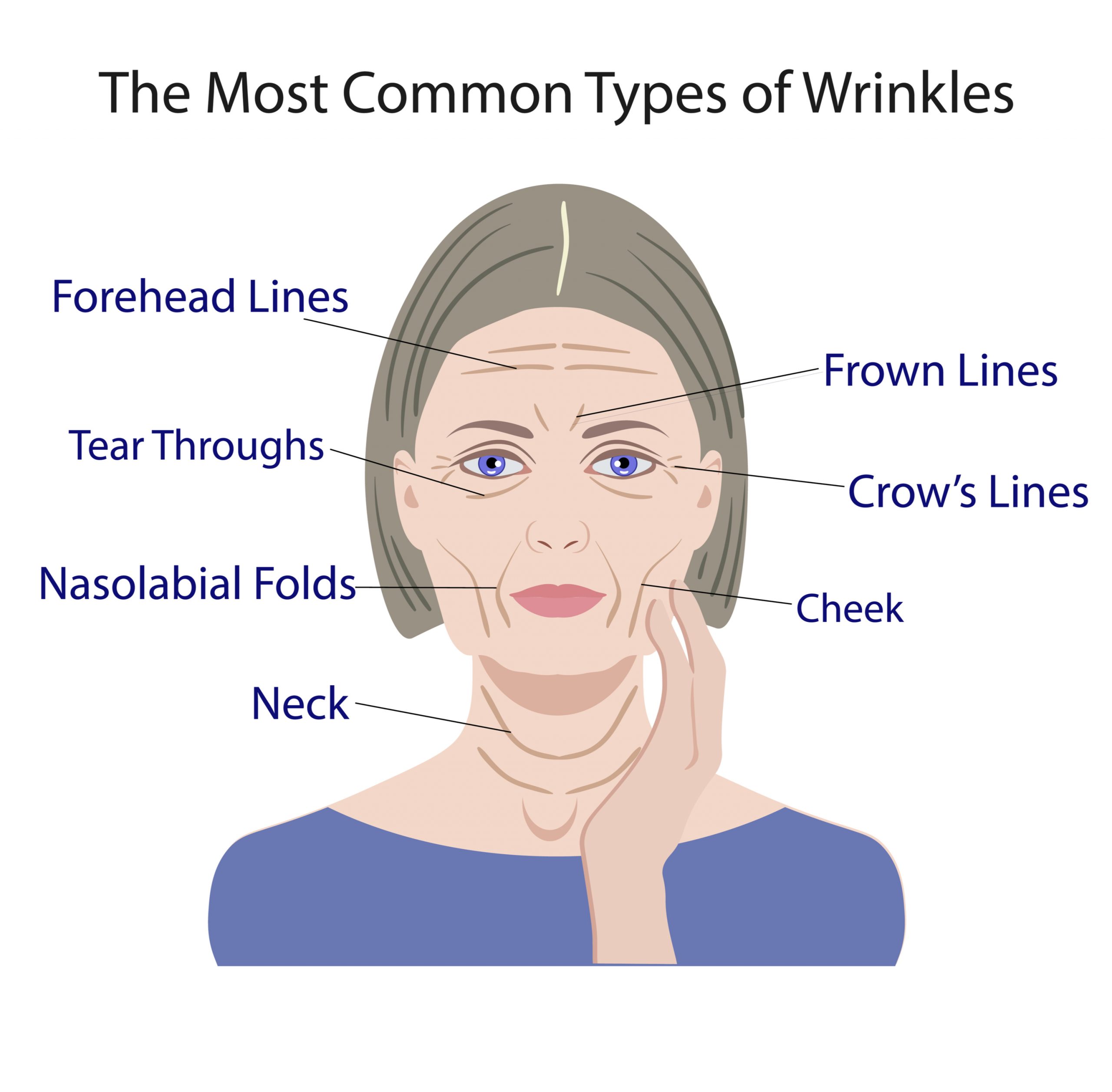Here's All You Need To Know About Types Of Wrinkles And Tips To